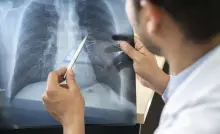 Tabagismo é maior entre jovens de 16 a 24 anos, alerta pesquisa