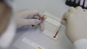 Saúde fará testagem para HIV e hepatite durante evento da OAB na zona norte