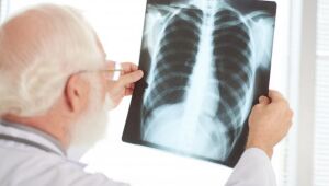 Levantamento no Alto Tietê aponta 594 casos de tuberculose em 2025