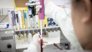 Após investigação, Governo de SP descarta caso suspeito do vírus Ebola em paciente internado