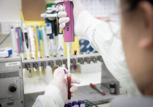 Após investigação, Governo de SP descarta caso suspeito do vírus Ebola em paciente internado
