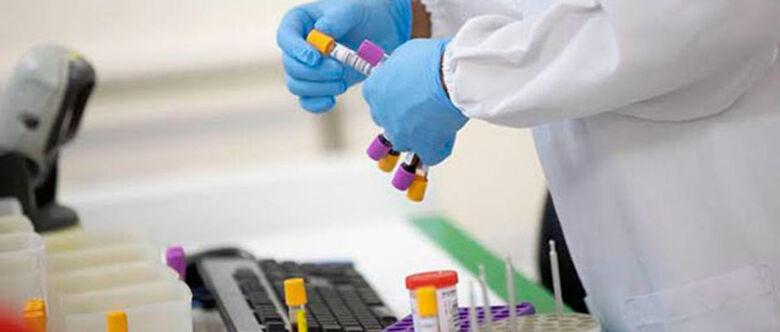 Alto Tietê registrou 66 casos de meningite bacteriana