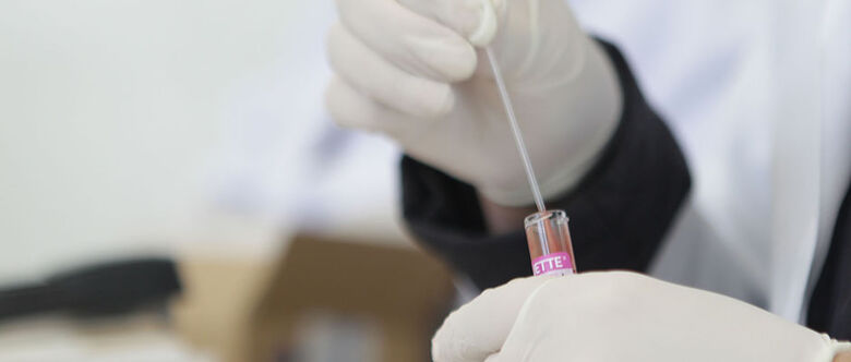 Secretaria de Saúde deu início à campanha que promove a intensificação de testes 