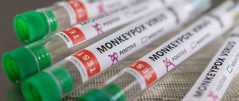 Cidades confirmaram 71 casos confirmados de Mpox, a Monkeypox, em 2022