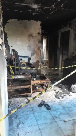 Ex-namorado incendeia apartamento e tem 40% do corpo queimado