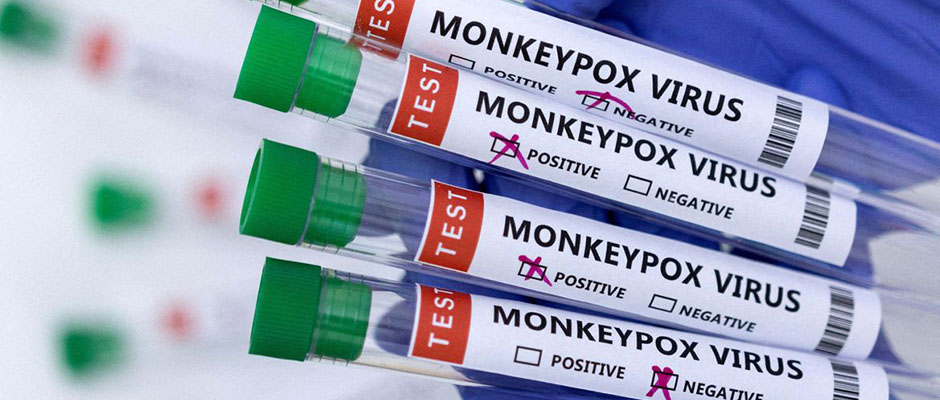 São Paulo lança plano de enfrentamento à varíola dos macacos
